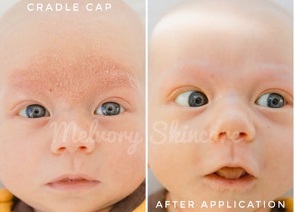 Baby Bum Balm